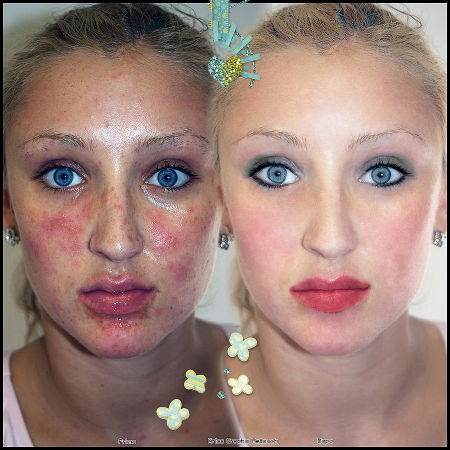 Retouch Difficile 